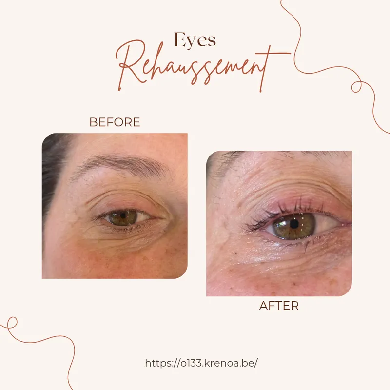 Rehaussement de cils - Détail 1